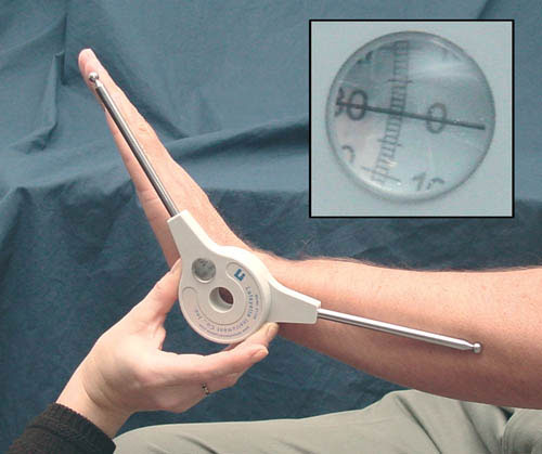 Extendable Goniometer (Goniometers) - Img 1