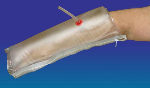 Inflatable Air Splint Half-Arm 25 – Medical Supply HQ