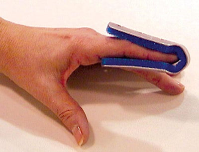 Fold Over Finger Splint Small Bulk  PK/6 Non-Retail (Finger Splints/Cots/Covers) - Img 1