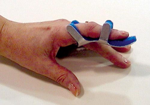 Toad Finger Splint Small Bulk  PK/6 Non-Retail (Finger Splints/Cots/Covers) - Img 1