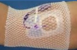 ProNet Elastic Net Retainer Dressing, 8-Inch Length, 1 Bag of 100 (General Wound Care) - Img 2