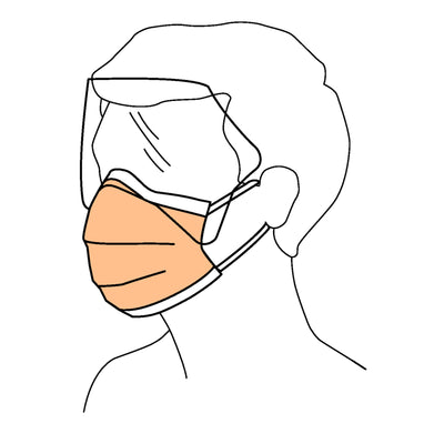 FluidShield Procedure Mask with Eye Shield Anti-fog Orange, NonSterile, 1 Box of 25 (Masks) - Img 3