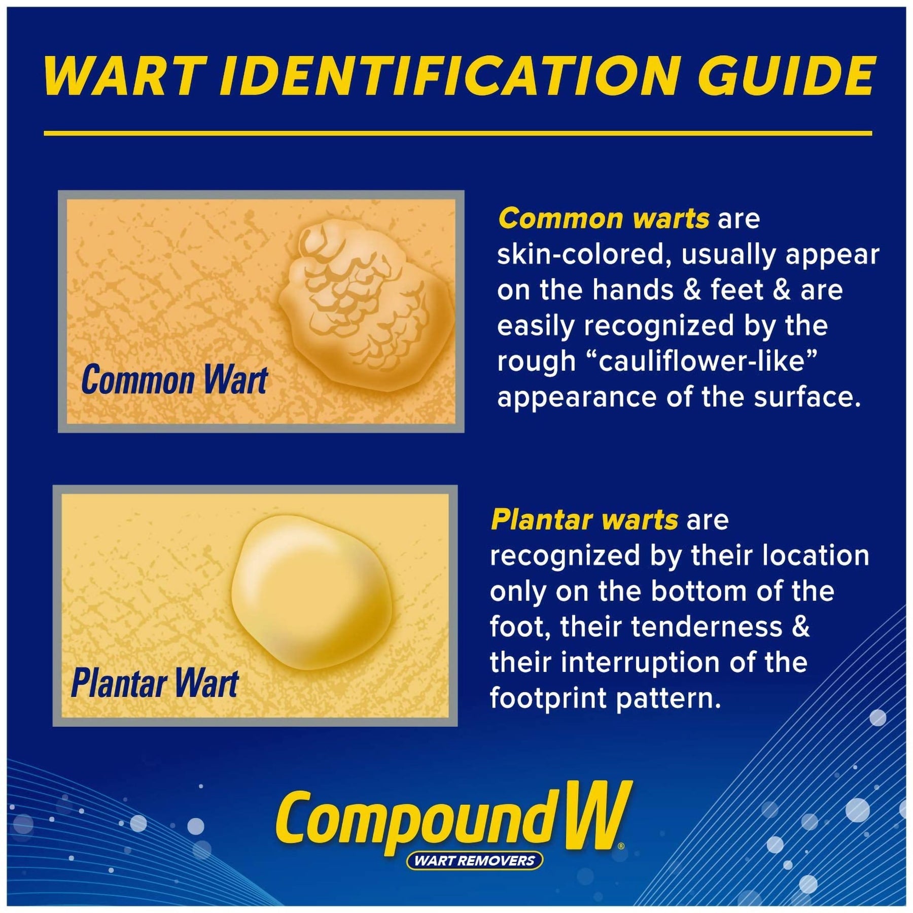 Compound W® Freeze Off® Dimethyl Ether / Propane Wart Remover – Medical  Supply HQ