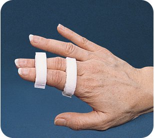 FINGER SPLINT, BUDDY HOOK LOOPSMALL 1/2" (10/PK) (Immobilizers, Splints and Supports) - Img 1