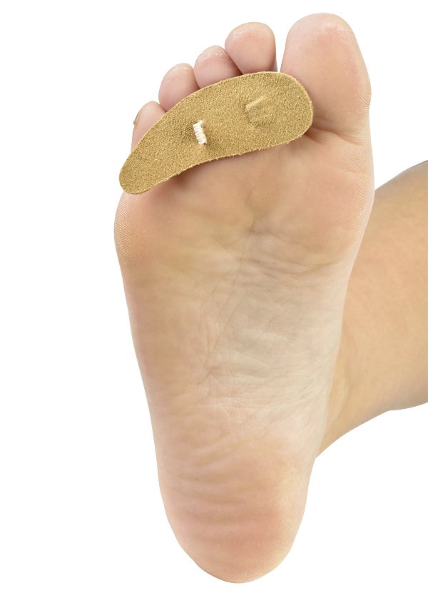 TOE CREST, HAMMER TOE FELT LT SM (Immobilizers, Splints and Supports) - Img 2