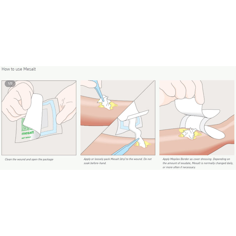 Mesalt® Sodium Chloride Impregnated Dressing, 4 x 4 Inch / 2 x 2 Inch Folded, 1 Each (Advanced Wound Care) - Img 2