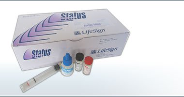 Status Infectious Mononucleosis Disease Immunoassay Rapid Test Kit, 1 Box of 10 (Test Kits) - Img 1